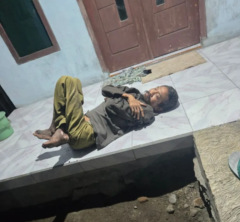 Tinggal Sendirian, ODGJ Asal Kedungringin Bakar Rumahnya